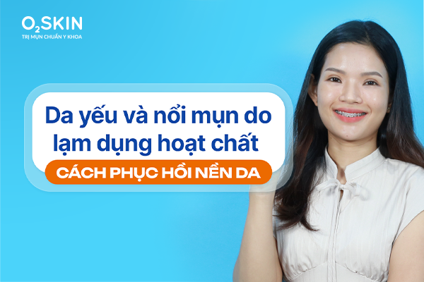 Da nổi mụn viêm do lạm dụng treatment: Phác đồ 6 tuần của bác sĩ