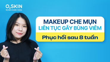 Makeup che mụn liên tục gây bùng viêm: Phục hồi sau 8 tuần