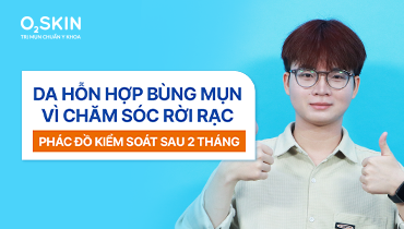 Da hỗn hợp bùng mụn vì chăm sóc rời rạc: Phác đồ kiểm soát sau 2 tháng