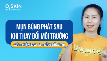 Mụn bùng phát sau khi thay đổi môi trường: Cải thiện sau 12 tuần điều trị