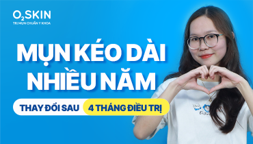 Mụn kéo dài nhiều năm: Thay đổi sau 4 tháng điều trị