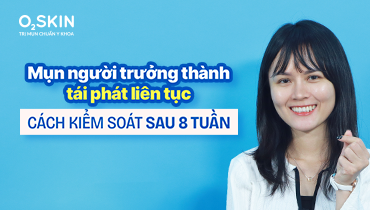 Mụn người trưởng thành tái phát liên tục: Cách kiểm soát sau 8 tuần