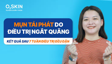 Mụn tái phát do điều trị ngắt quãng: Kết quả sau 7 tuần điều trị đều đặn