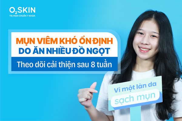 Mụn viêm khó ổn định do ăn nhiều đồ ngọt: Theo dõi cải thiện sau 8 tuần