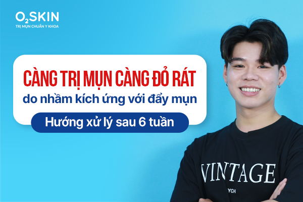 cang-tri-mun-cang-do-rat-do-nham-kich-ung-voi-day-mun-huong-xu-ly-sau-6-tuan