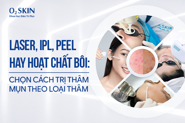 Laser, IPL, Peel hay Hoạt chất bôi: Chọn cách trị thâm mụn theo loại thâm