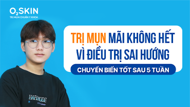 Trị mụn mãi không hết vì điều trị sai hướng: Chuyển biến tốt sau 5 tuần