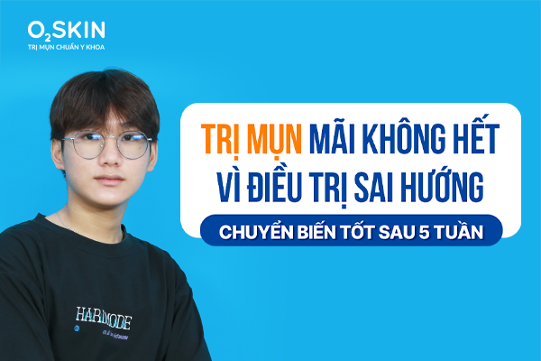 tri-mun-mai-khong-het-chuyen-bien-tot-sau-5-tuan