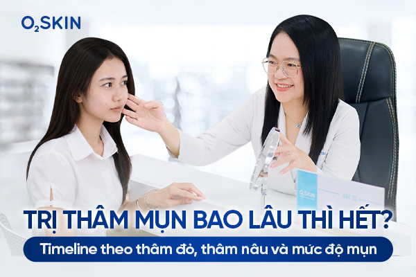 Trị thâm mụn bao lâu thì hết? Timeline theo thâm đỏ, thâm nâu và mức độ mụn