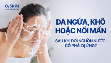 Da ngứa, khô hoặc nổi mẩn sau khi đổi nguồn nước: Có phải dị ứng?