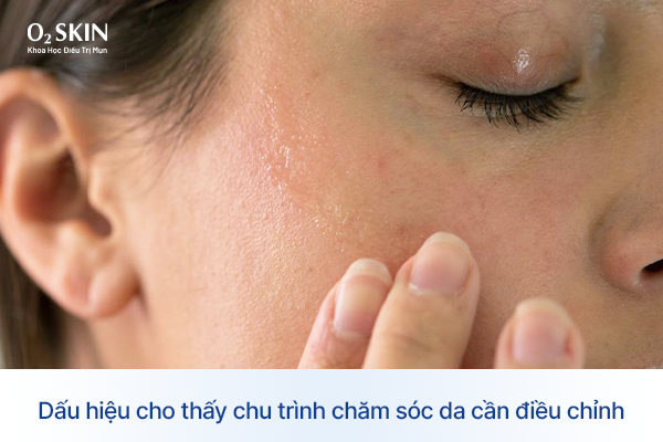 Dấu hiệu cho thấy chu trình chăm sóc da cần điều chỉnh