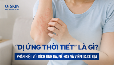 “Dị ứng thời tiết” là gì? Phân biệt với kích ứng da, mề đay và viêm da cơ địa