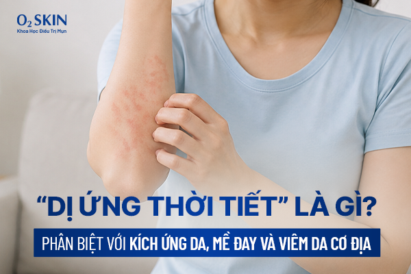 “Dị ứng thời tiết” là gì? Phân biệt với kích ứng da, mề đay và viêm da cơ địa