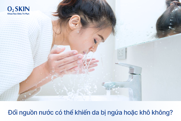 Đổi nguồn nước có thể khiến da bị ngứa hoặc khô không? Đổi nguồn nước có thể khiến da bị ngứa hoặc khô không?
