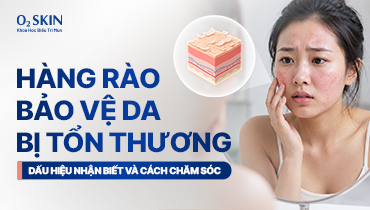 Hàng rào bảo vệ da bị tổn thương: Dấu hiệu nhận biết và cách chăm sóc