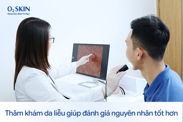 Thăm khám da liễu giúp đánh giá nguyên nhân tốt hơn