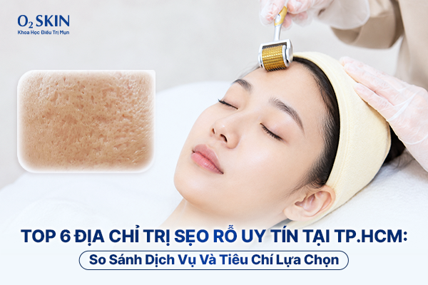 Top 6 địa chỉ trị sẹo rỗ uy tín tại TP.HCM: So sánh dịch vụ và tiêu chí lựa chọn