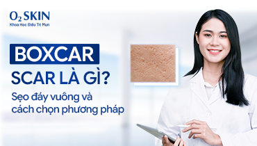 Boxcar scar là gì? Sẹo đáy vuông và cách chọn phương pháp