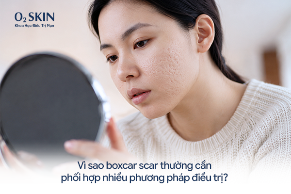 Vì sao boxcar scar thường cần phối hợp nhiều phương pháp điều trị?