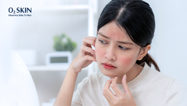 Da bị kích ứng khi đi du lịch hoặc chuyển nơi ở: Nên chuẩn bị và xử lý thế nào?