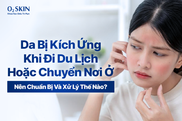 Da bị kích ứng khi đi du lịch hoặc chuyển nơi ở: Nên chuẩn bị và xử lý thế nào?